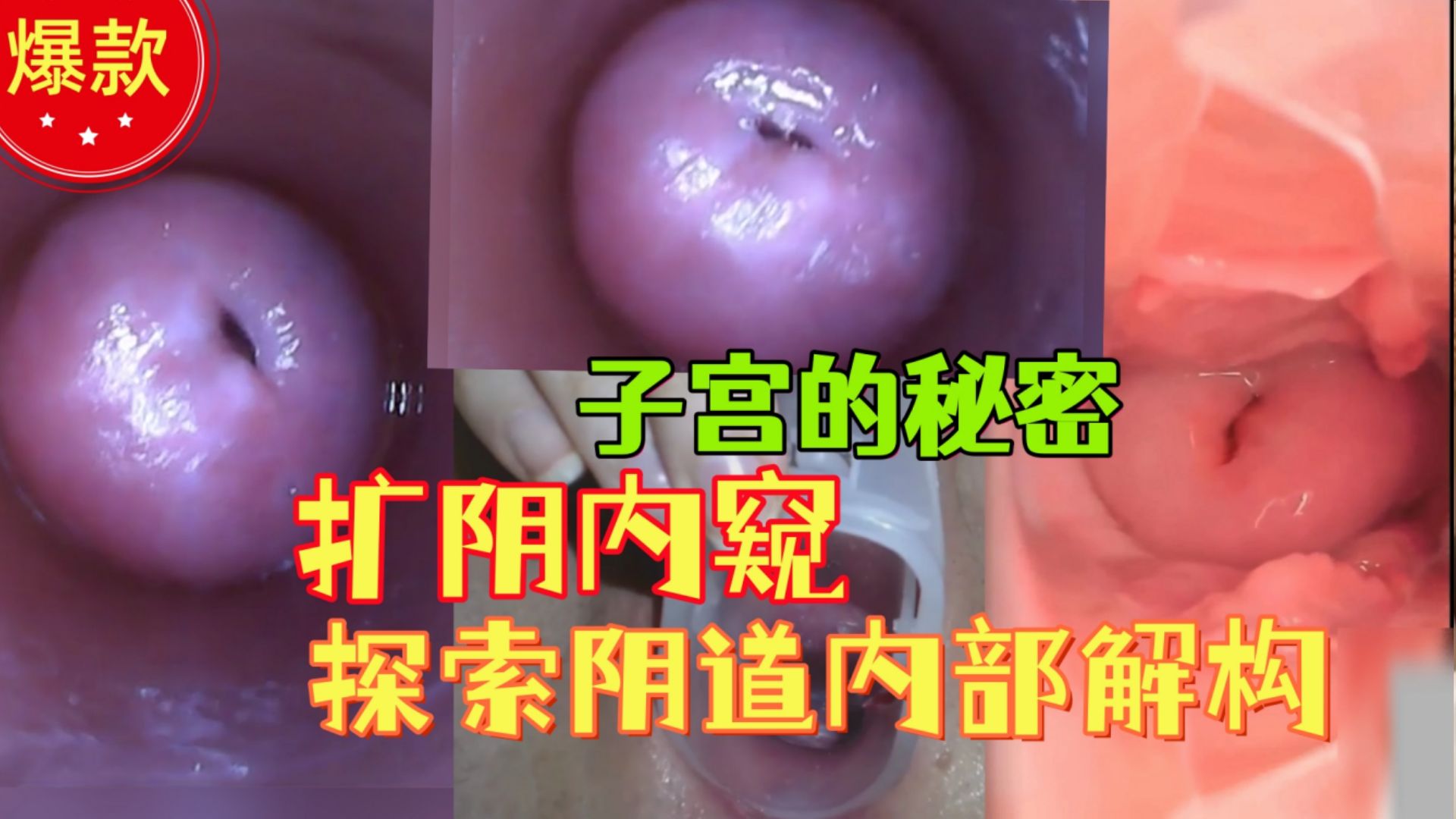 {扩阴内窥子宫}把摄像头插入阴道观察子宫解构，从内部探索女性生殖器解构，独家稀缺资源！
